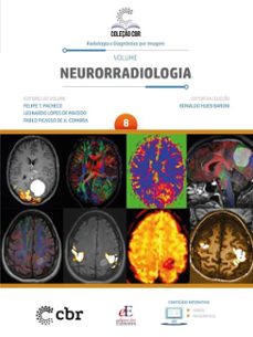 volume 8 - neurorradiologia (ebook)-ronaldo hueb baroni-felipe t. pacheco-leonardo lopes de macedo-9786561031004