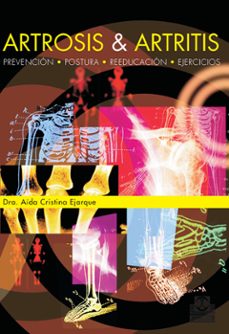 artrosis y artritis-aida cristina ejarque-9788480190404