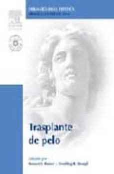 trasplante de pelo (incluye dvd)-9788480862004