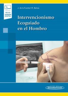 intervencionismo ecoguiado en el hombro (incluye ebook-9788491104704