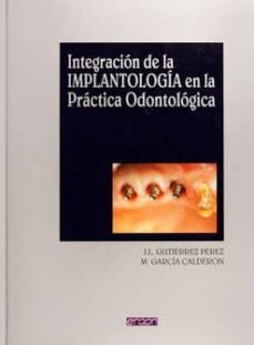 integracion de la implantologia en la practica odontologica-9788484730514