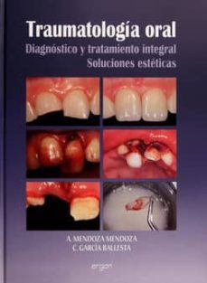 traumatologia oral-a. mendoza mendoza-carlos garcia ballesta-9788484739814