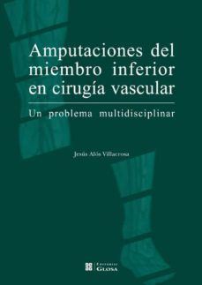 amputaciones del miembro inferior en cirugia vascular-jesus alos villacrosa-9788474293524