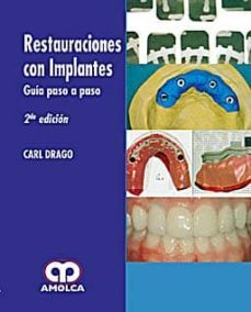 restauraciones con implantes. guia paso a paso-carl drago-9789588473024