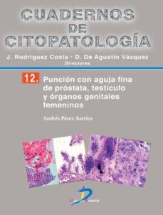 punción con aguja fina de próstata, testículo y órganos genitales femeninos (ebook)-andres perez barrios-9788490520734