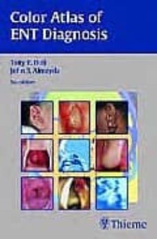 color atlas of ent diagnosis-tony bull-9783131293954