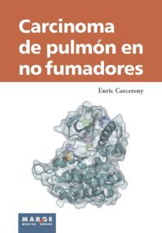 carcinoma de pulmón en no fumadores (ebook)-9788416171354