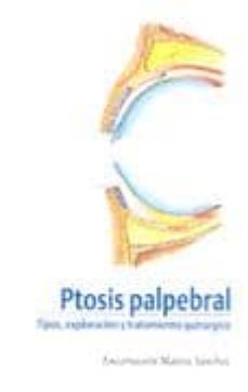 ptosis palpebral: tipos, exploracion y tratamiento quirurgico-encarnacion materos sanchez-9788484733164