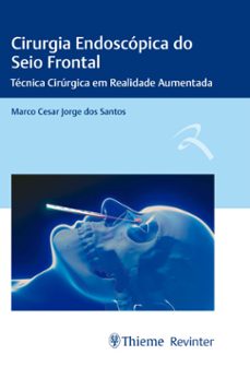 cirurgia endoscopica do seio frontal (ebook)-marco cesar jorge dos santos-9786555720884