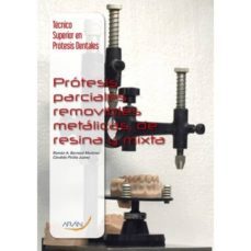 protesis parciales y removibles metalicas, de resina y mixta (tecnico superior en protesis dentales)-9788416141784