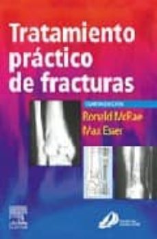 tratamiento practico de las fractuas (4ª ed.)-9788481746884