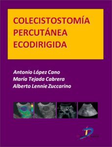 colecistostomia percutanea ecodirigida (ebook)-antonio lopez cano-maria tejada cabrera-alberto lennie zuccarino-9788499697284