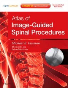 atlas of image - guided spinal procedures, expert consult - onlin e and print-9780323042994