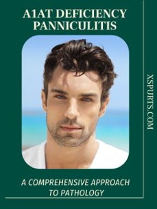 a1at deficiency panniculitis (ebook)-wyatt u. sinclair-9781776841394
