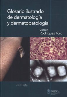 glosario ilustrado de dermatologia y dermatopatologia (ebook)-gerzain rodriguez toro-9789587013894