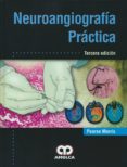 neuroangiografia practica (3ª ed.)-9789588950044 neuroangiografia practica (3ª ed.)-9789588950044