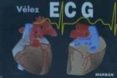 e.c.g. electrocardiografia (2ª ed.)-9788471015594 e.c.g. electrocardiografia (2ª ed.)-9788471015594