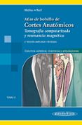 atlas cortes anatómicos, 2ª ed t3-torsten b. möller-9788491102694 atlas cortes anatómicos, 2ª ed t3-torsten b. möller-9788491102694