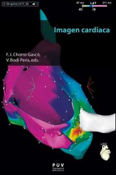 Descargas de libros electrónicos gratis para compartir IMAGEN CARDIACA RTF FB2 CHM (Spanish Edition) de F.J. CHORRO GASCO 9788437097114