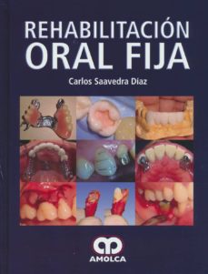 Descargar libros en francés mi kindle REHABILITACION ORAL FIJA de SAAVEDRA