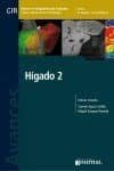 Libros en ingls para descargar gratis HIGADO 2: AVANCES EN DIAGNOSTICO POR IMAGENES 16 de C. - STOOPEN, M. AYUSO  (Spanish Edition) 9789873954344