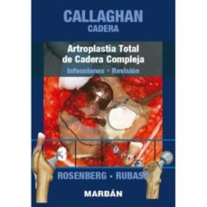 Descargar kindle book como pdf CALLAGHAN: CADERA: ARTROPLASTIA TOTAL DE CADERA COMPLEJA: INFECCIONES - REVISION (Spanish Edition)