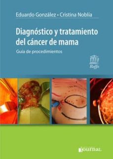 Descargas gratuitas en formato ebook pdf DIAGNOSTICO Y TRATAMIENTO DEL CANCER DE MAMA: GUIA DE PROCEDIMIENTOS de GONZALEZ 9789871981984 (Spanish Edition) PDB ePub
